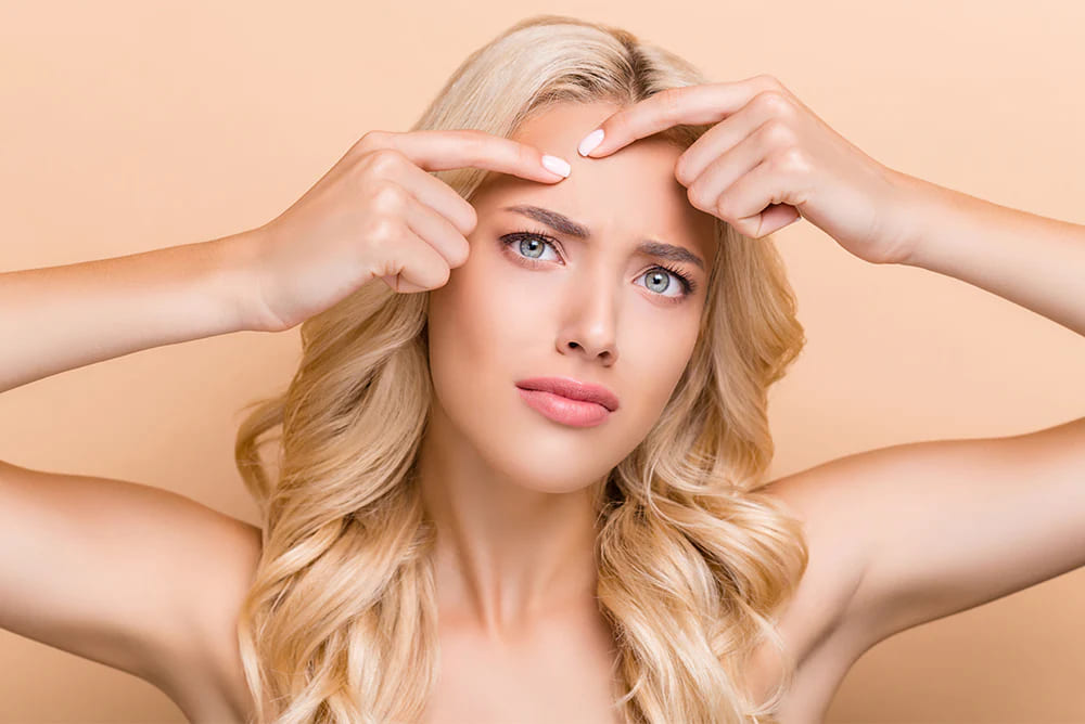 Acne treatment