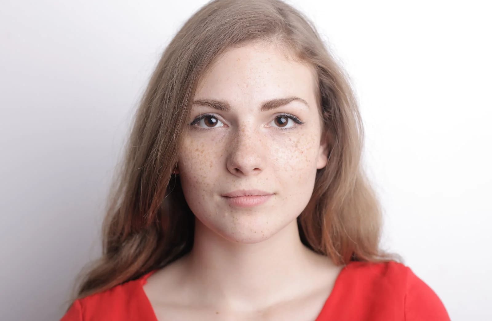 Dark spots on face